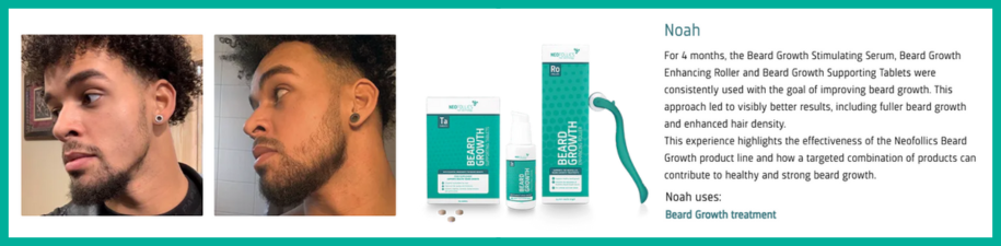 Neofollics - Beard Growth